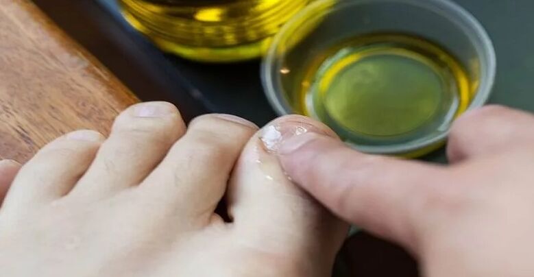 Aceites esenciais para combater os cogomelos