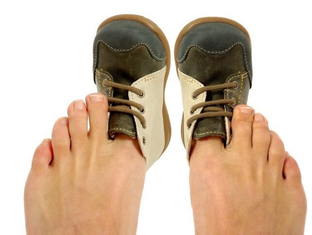 zapatos axustados como causa de fungo entre os dedos dos pés