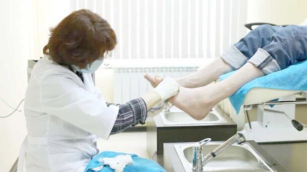 Un dermatólogo trata o fungo das unhas dos pés