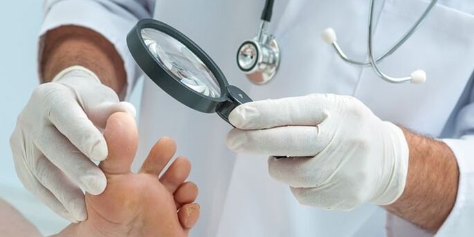 O médico examinou o pé infectado cun cogomelo